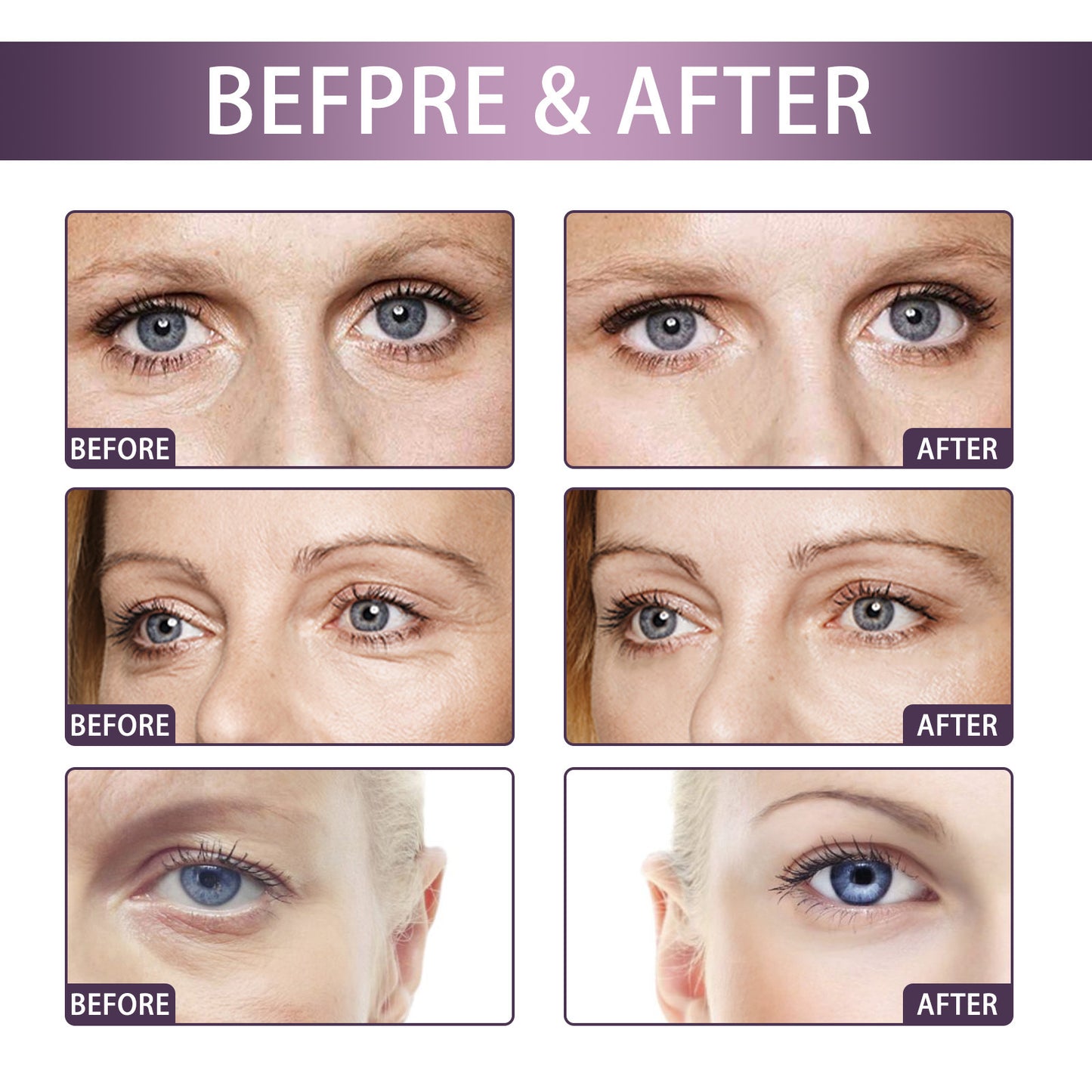 Crema reafirmante para el cuidado de los ojos, hidratante y aclarante, reafirmante