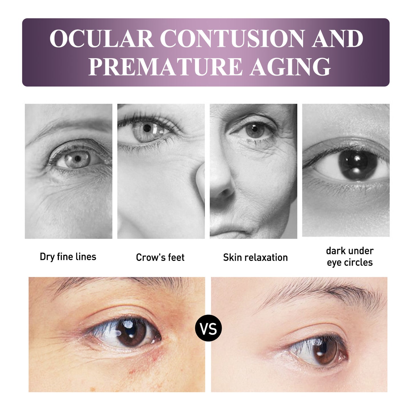 Crema reafirmante para el cuidado de los ojos, hidratante y aclarante, reafirmante